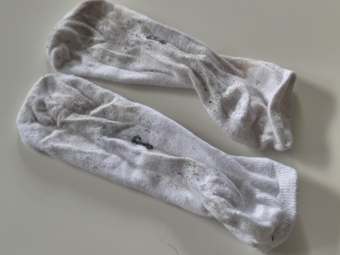 Socken von 40 jährigen ind er gastroschicht getragen